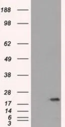 Anti-SSX2 antibody [4D10] used in Western Blot (WB). GTX83555