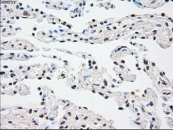 Anti-SSB antibody [9D6] used in IHC (Paraffin sections) (IHC-P). GTX83557