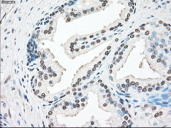 Anti-SSB antibody [9D6] used in IHC (Paraffin sections) (IHC-P). GTX83557