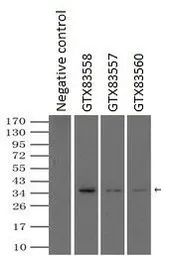 Anti-SSB antibody [9D6] used in Immunoprecipitation (IP). GTX83557