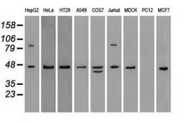 Anti-SSB antibody [9D6] used in Western Blot (WB). GTX83557