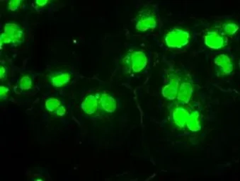 Anti-SSB antibody [9D6] used in Immunocytochemistry/ Immunofluorescence (ICC/IF). GTX83557