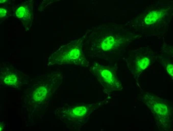 Anti-SSB antibody [9D6] used in Immunocytochemistry/ Immunofluorescence (ICC/IF). GTX83557
