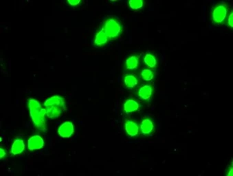 Anti-SSB antibody [3H9] used in Immunocytochemistry/ Immunofluorescence (ICC/IF). GTX83560