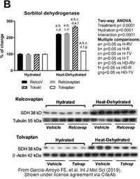 Anti-Sorbitol Dehydrogenase antibody [1D5] used in Western Blot (WB). GTX83588