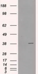 Anti-Sorbitol Dehydrogenase antibody [1D5] used in Western Blot (WB). GTX83588