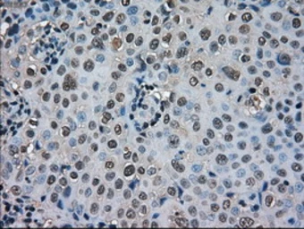 Anti-SOD1 antibody [8B10] used in IHC (Paraffin sections) (IHC-P). GTX83592