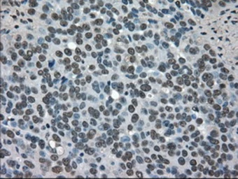 Anti-SOD1 antibody [8B10] used in IHC (Paraffin sections) (IHC-P). GTX83592