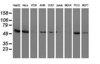 Anti-Syntrophin alpha 1 antibody [2B9] used in Western Blot (WB). GTX83606
