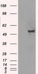 Anti-GLUT5 antibody [20E1] used in Western Blot (WB). GTX83631