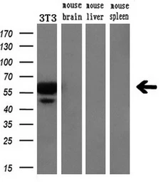 Anti-VMAT2 antibody [9E11] used in Western Blot (WB). GTX83635