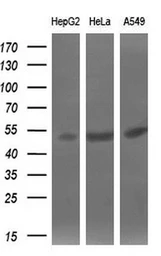 Anti-SIL1 antibody [3E3] used in Western Blot (WB). GTX83642