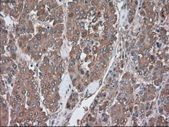 Anti-alpha 1 Antitrypsin antibody [9A1] used in IHC (Paraffin sections) (IHC-P). GTX83666