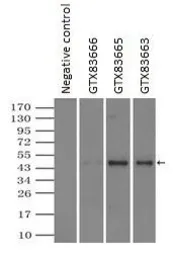 Anti-alpha 1 Antitrypsin antibody [9A1] used in Immunoprecipitation (IP). GTX83666