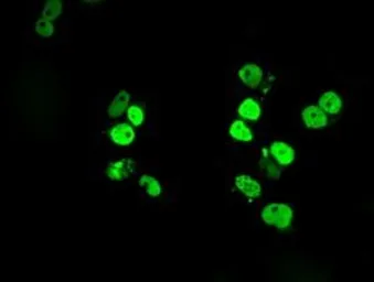 Anti-SATB1 antibody [11E8] used in Immunocytochemistry/ Immunofluorescence (ICC/IF). GTX83679