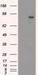 Anti-SATB1 antibody [10G2] used in Western Blot (WB). GTX83684
