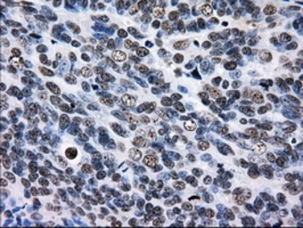 Anti-RPA32 antibody [8B3] used in IHC (Paraffin sections) (IHC-P). GTX83688