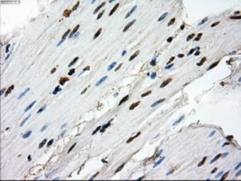 Anti-RPA32 antibody [8B3] used in IHC (Paraffin sections) (IHC-P). GTX83688