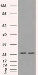 Anti-RPA32 antibody [7C12] used in Western Blot (WB). GTX83695