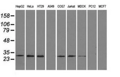 Anti-RPA32 antibody [7C12] used in Western Blot (WB). GTX83695