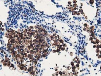 Ribonuclease Inhibitor antibod