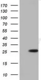 Anti-RND1 antibody [1C3] used in Western Blot (WB). GTX83708