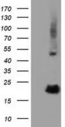 Anti-RBBP9 antibody [4G3] used in Western Blot (WB). GTX83717