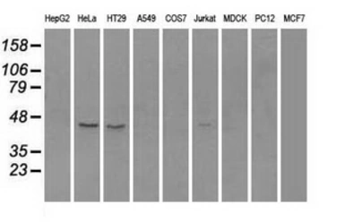 Anti-RAD9A antibody [7B11] used in Western Blot (WB). GTX83736