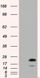 Anti-RAB17 antibody [4E7] used in Western Blot (WB). GTX83739