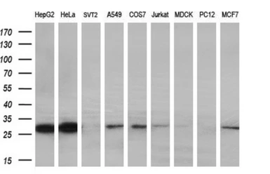 Anti-PYCRL antibody [2E10] used in Western Blot (WB). GTX83750