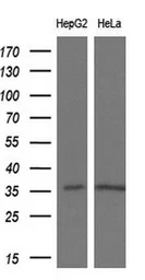Anti-PYCR2 antibody [4A10] used in Western Blot (WB). GTX83752