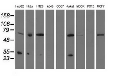 Anti-PYCR2 antibody [2F11] used in Western Blot (WB). GTX83754