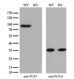 Anti-PUS7 antibody [4H5] used in Western Blot (WB). GTX83756