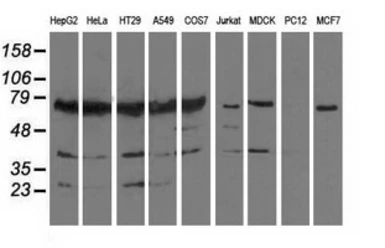Anti-PUS7 antibody [4H5] used in Western Blot (WB). GTX83756