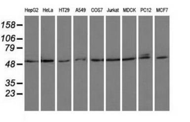 Anti-PSMC3 antibody [1C10] used in Western Blot (WB). GTX83784