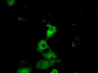 Anti-PKA R2 antibody [1B4] used in Immunocytochemistry/ Immunofluorescence (ICC/IF). GTX83826