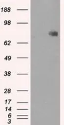 Anti-POR antibody [1B11] used in Western Blot (WB). GTX83858