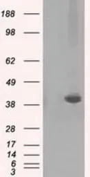 Anti-Pleckstrin antibody [2D11] used in Western Blot (WB). GTX83872