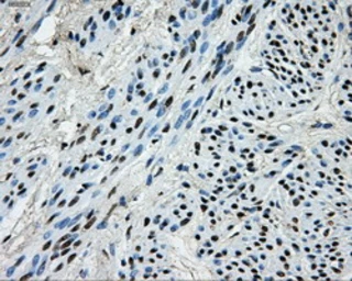 Anti-PKMYT1 antibody [5E1] used in IHC (Paraffin sections) (IHC-P). GTX83877