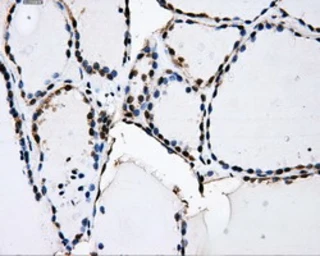 Anti-PKMYT1 antibody [5E1] used in IHC (Paraffin sections) (IHC-P). GTX83877