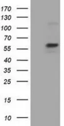 Anti-Pyruvate Kinase (liver/RBC) antibody [1C7] used in Western Blot (WB). GTX83878