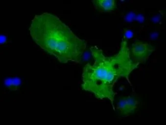 Anti-Pyruvate Kinase (liver/RBC) antibody [1C7] used in Immunocytochemistry/ Immunofluorescence (ICC/IF). GTX83878