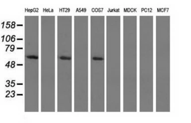 Anti-Pyruvate Kinase (liver/RBC) antibody [1A5] used in Western Blot (WB). GTX83885