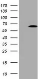 Anti-Pyruvate Kinase (liver/RBC) antibody [1A5] used in Western Blot (WB). GTX83885
