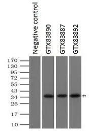 Anti-PIM2 antibody [8G10] used in Immunoprecipitation (IP). GTX83890