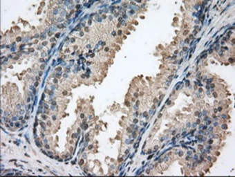 Anti-PIM2 antibody [9A5] used in IHC (Paraffin sections) (IHC-P). GTX83892