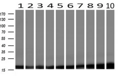 Anti-Profilin 1 antibody [1D5] used in Western Blot (WB). GTX83903