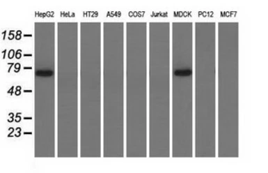 Anti-PEX5 antibody [1D3] used in Western Blot (WB). GTX83908