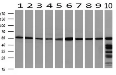 Anti-PEPD antibody [1B7] used in Western Blot (WB). GTX83909