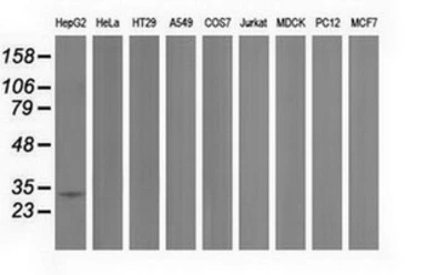 Anti-PECR antibody [1E4] used in Western Blot (WB). GTX83911